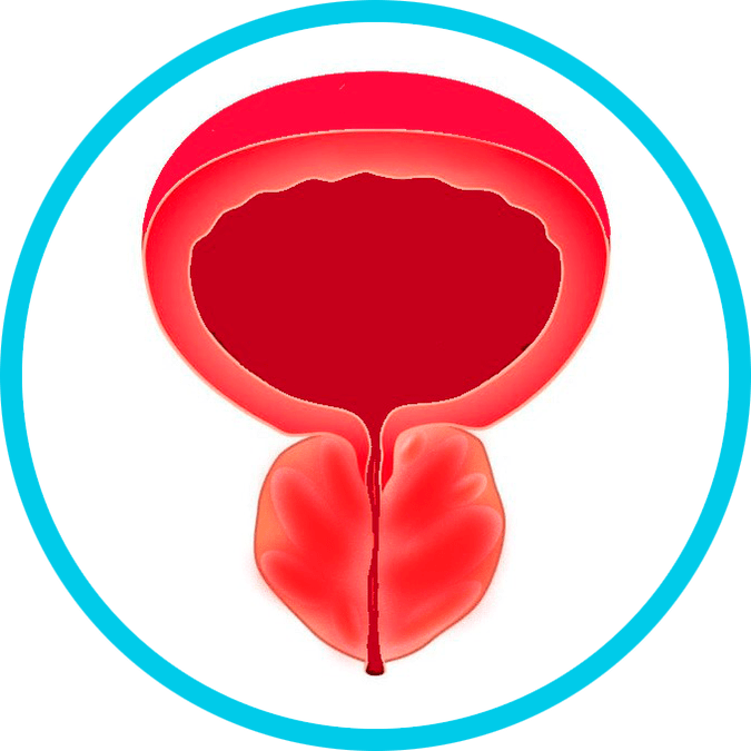 Príznaky prostatitídy